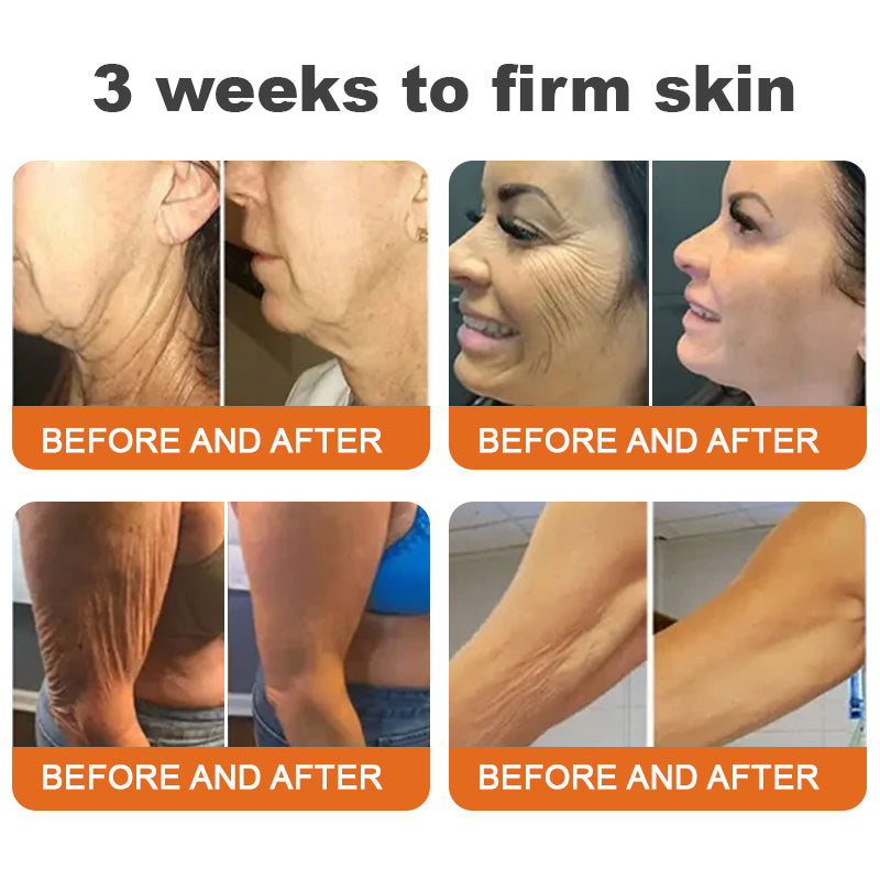 Made and shipped from New Zealand 🇳🇿Turonu™ Botox Bee Venom Firming Serum Stick (🔥Last Day 70% OFF)💄