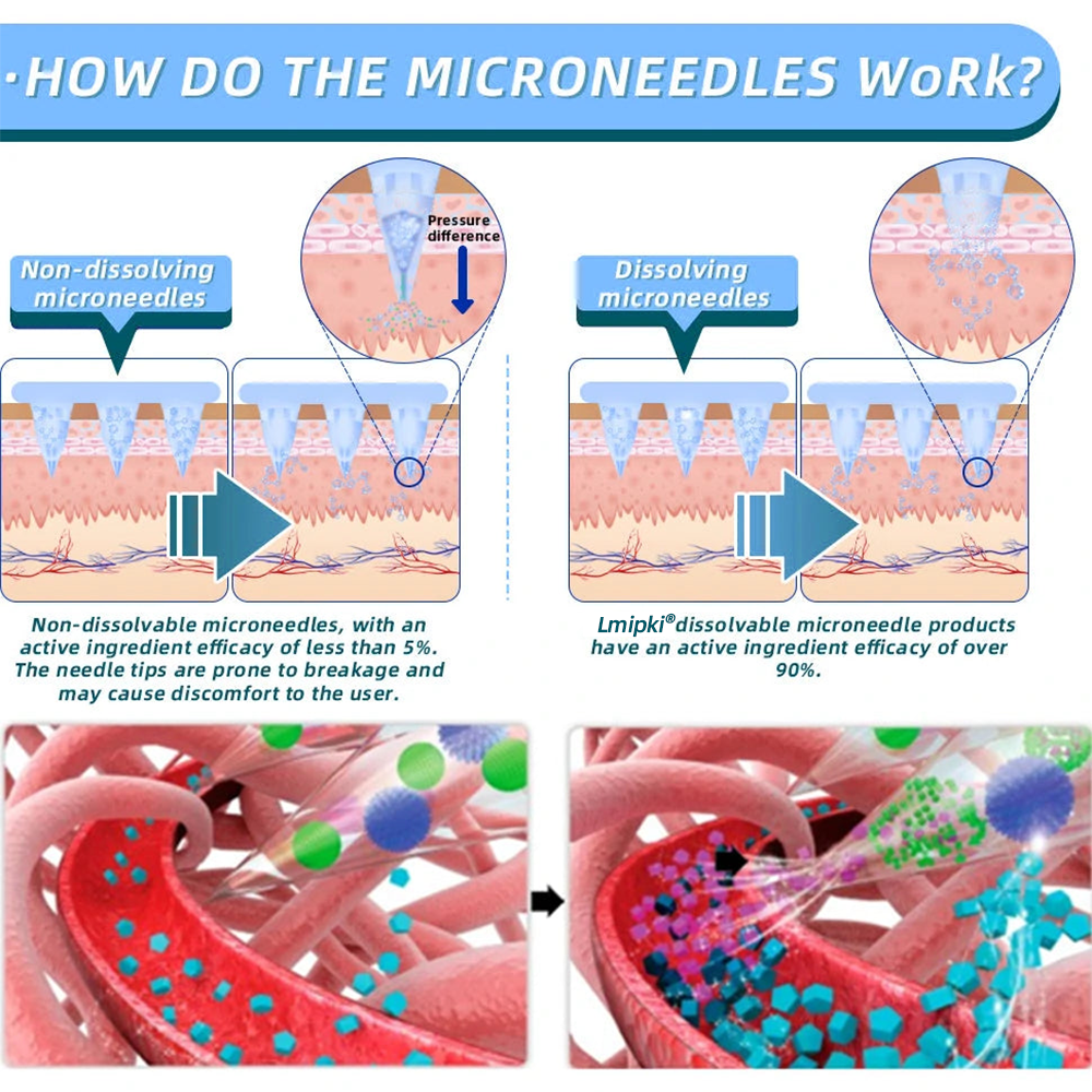 NZ Official Store: Lmipki® NIDDK-Tirzepatide Nano Microneedle Patch （Balance blood sugar, pain-free, with no side effects. Suitable for obesity and diabetes.）🔄