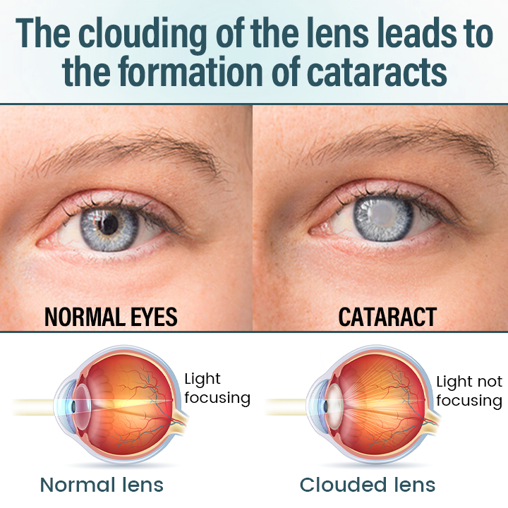 EQVP® 👩‍⚕️OptiFusion Nano Eye Drops Serum