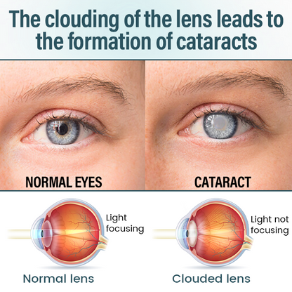 EQVP® 👩‍⚕️OptiFusion Nano Eye Drops Serum