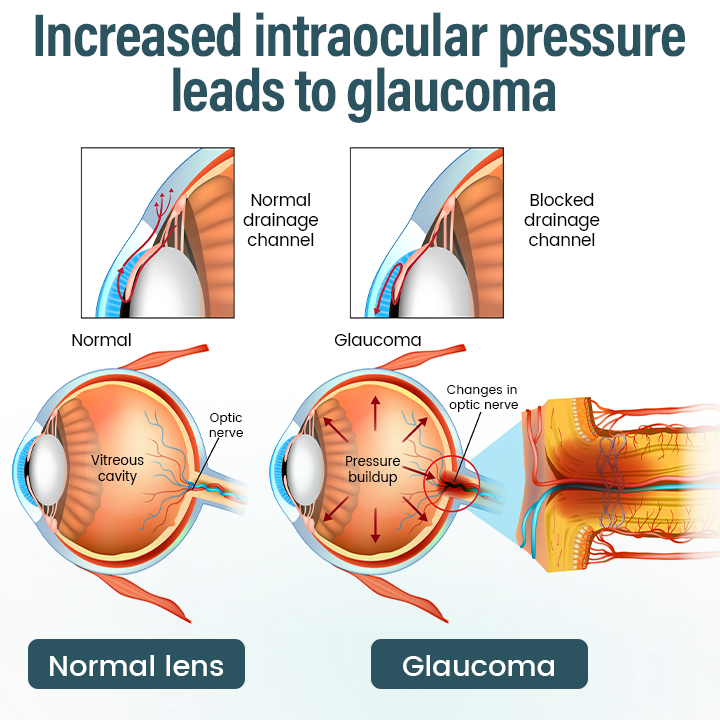 EQVP® 👩‍⚕️OptiFusion Nano Eye Drops Serum