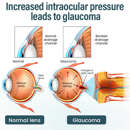 EQVP® 👩‍⚕️OptiFusion Nano Eye Drops Serum