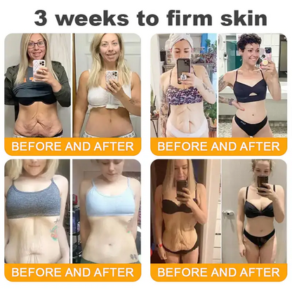 MEDSAFE Approved:Turonu®  Bee Venom Skin Restoration Cream — 🔥Limited Time 70% OFF🔥