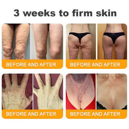 MEDSAFE Approved:Turonu®  Bee Venom Skin Restoration Cream — 🔥Limited Time 70% OFF🔥