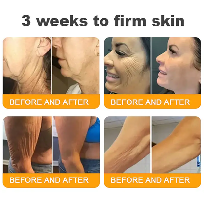 MEDSAFE Approved:Turonu®  Bee Venom Skin Restoration Cream — 🔥Limited Time 70% OFF🔥