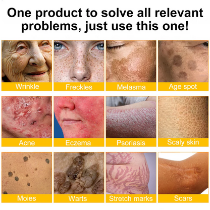 MEDSAFE Approved:Turonu®  Bee Venom Skin Restoration Cream — 🔥Limited Time 70% OFF🔥